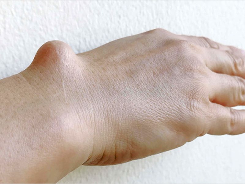 Orthopedic Diseases 10 Bone Tumor